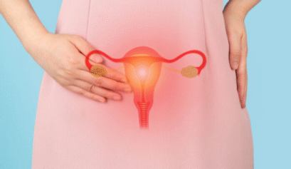 Polikistik Over Sendromu tedavisinde bariatrik cerrahinin doğurganlık üzerindeki etkisini anlatan görsel.