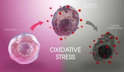 Oksidatif stres ve kronik stresin hücresel hasar, inflamasyon ve epigenetik etkilerini gösteren şematik görsel