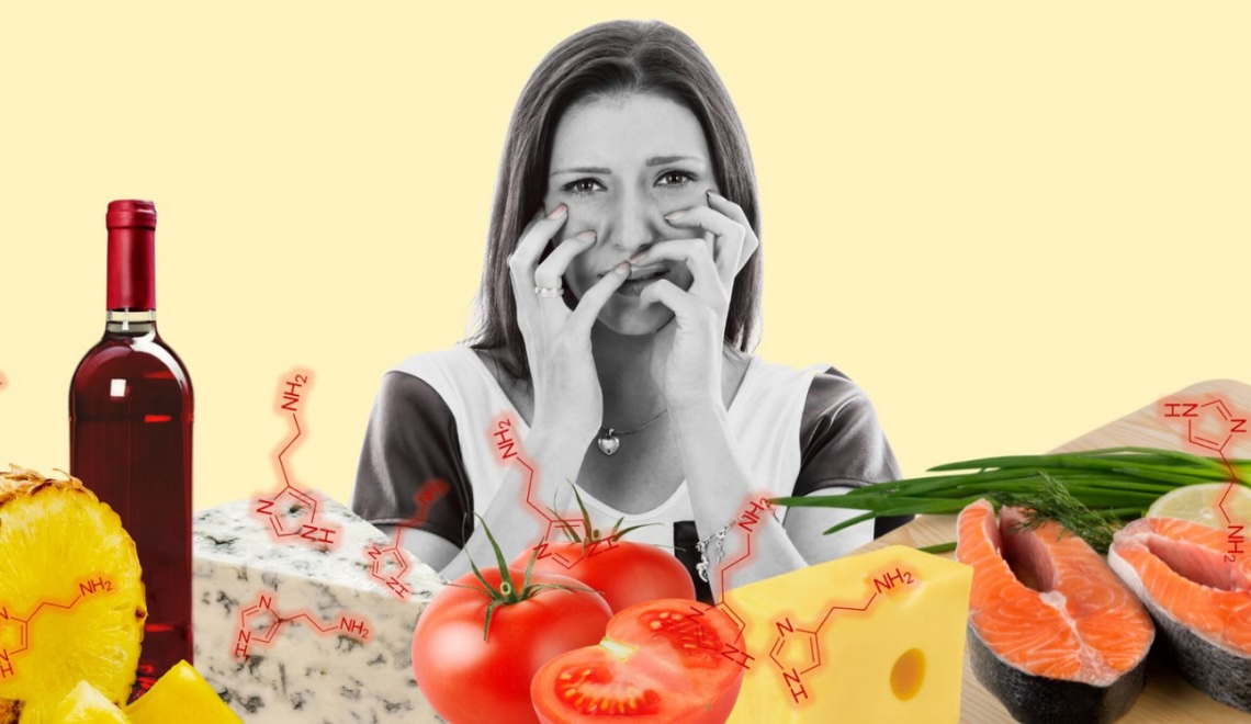 Histamin hassasiyeti, DAO gen varyasyonları ve epigenetik testler ile histamin metabolizmasının değerlendirilmesi