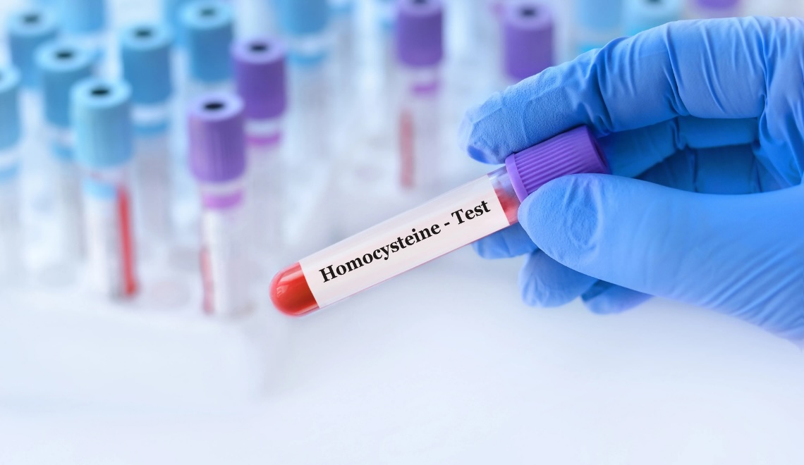 Homosistein yüksekliği ve düşüklüğünü, metilasyon döngüsünü ve kan testi tüpünü gösteren bilimsel görsel