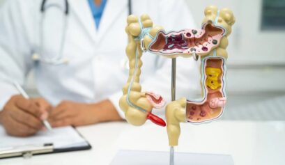 Geçirgen bağırsak ve sıkı bağlantı proteinlerini gösteren bağırsak epiteli illüstrasyonu