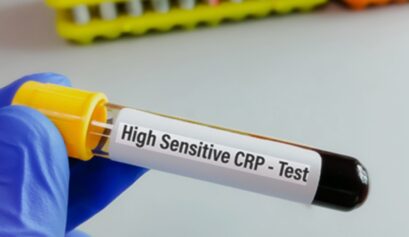 hsCRP testi için kan örneği alınan tüp ve kalp-damar sağlığını simgeleyen illüstrasyon