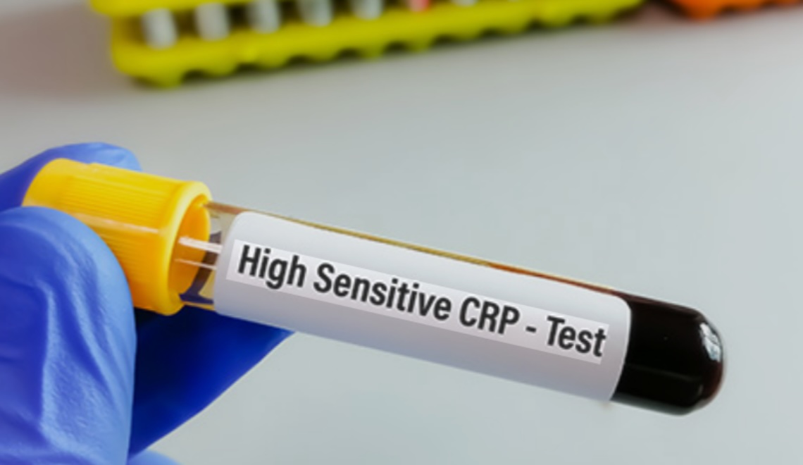 hsCRP testi için kan örneği alınan tüp ve kalp-damar sağlığını simgeleyen illüstrasyon
